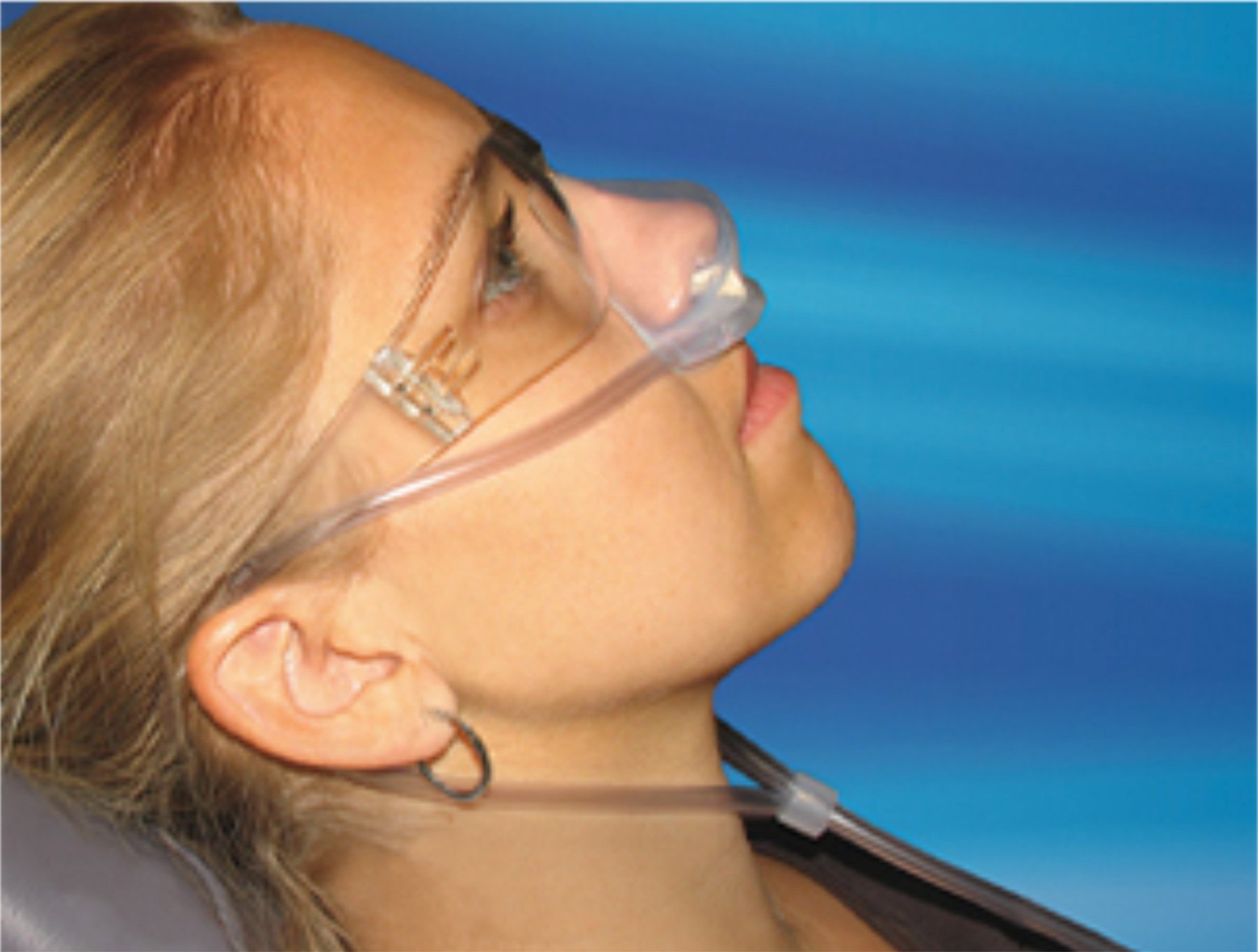 Silhouette® Nitrous Oxide Nasal Mask" (Copy)