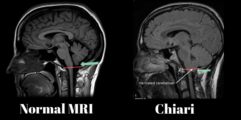 This scan image came from www.chiropractorwellington.com