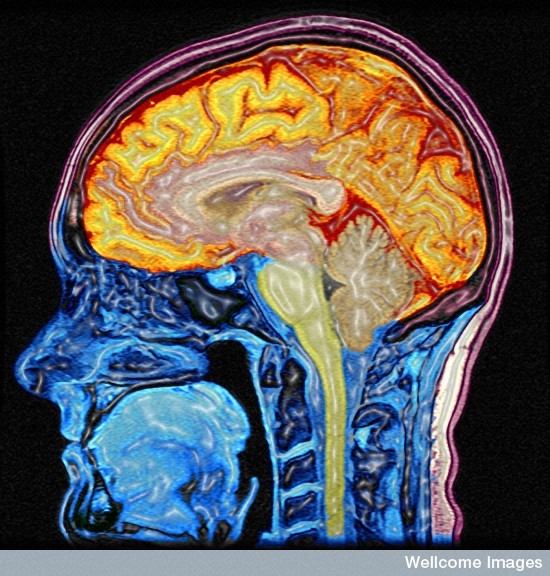'B0005622 Enhanced MRI scan of the head ' by Mark Lythgoe & Chloe Hutton / Wellcome Images, licenced under CC BY-NC-ND 2.0