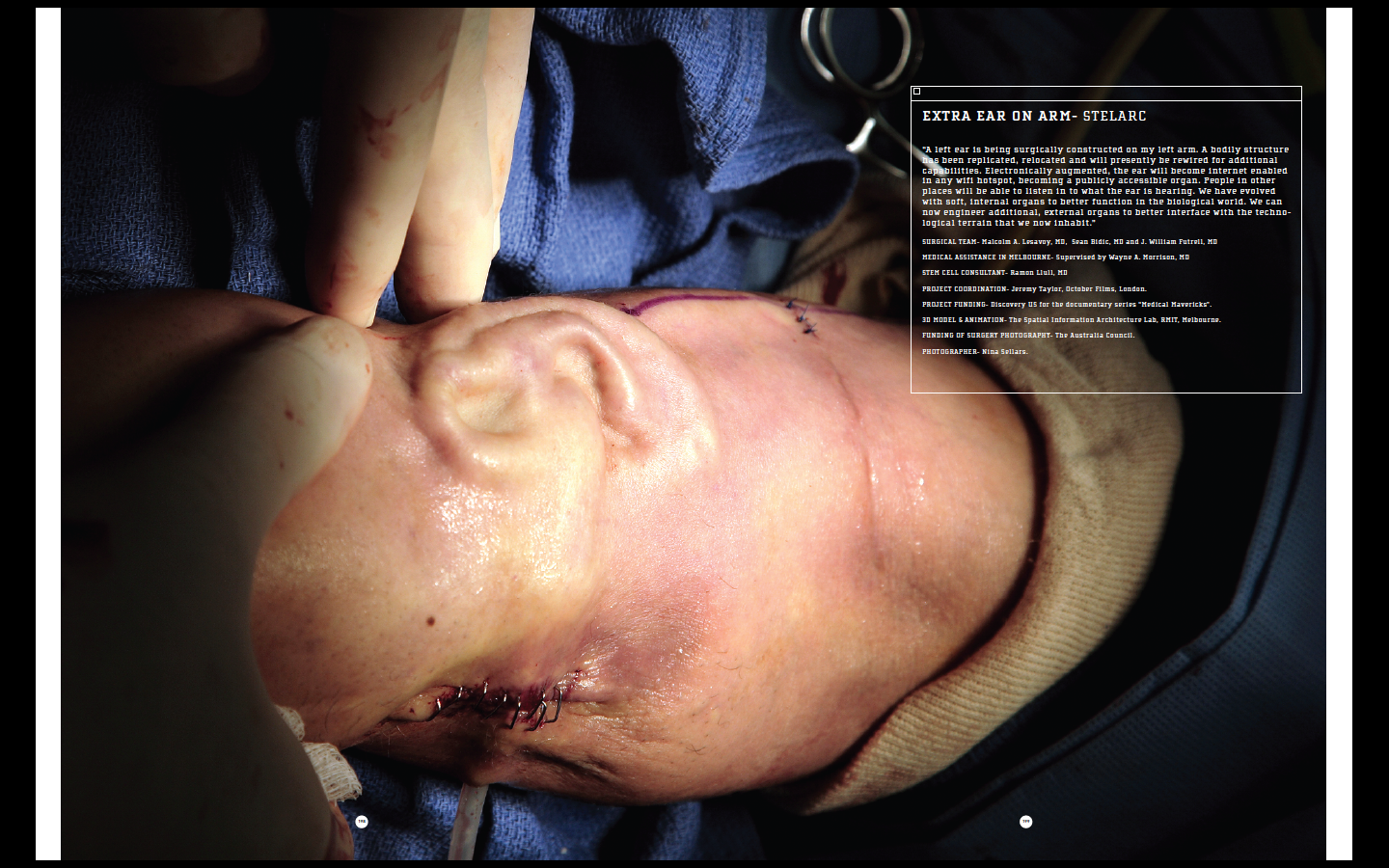 Human Enhancement: A Reply to Mehlman (2009)
