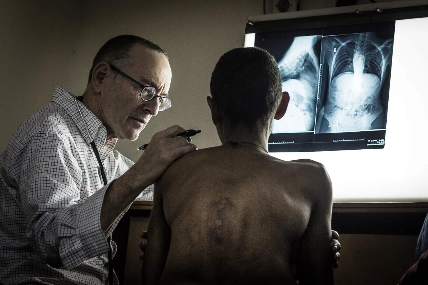 Dr. Hodes showing Bekelel his x-ray.