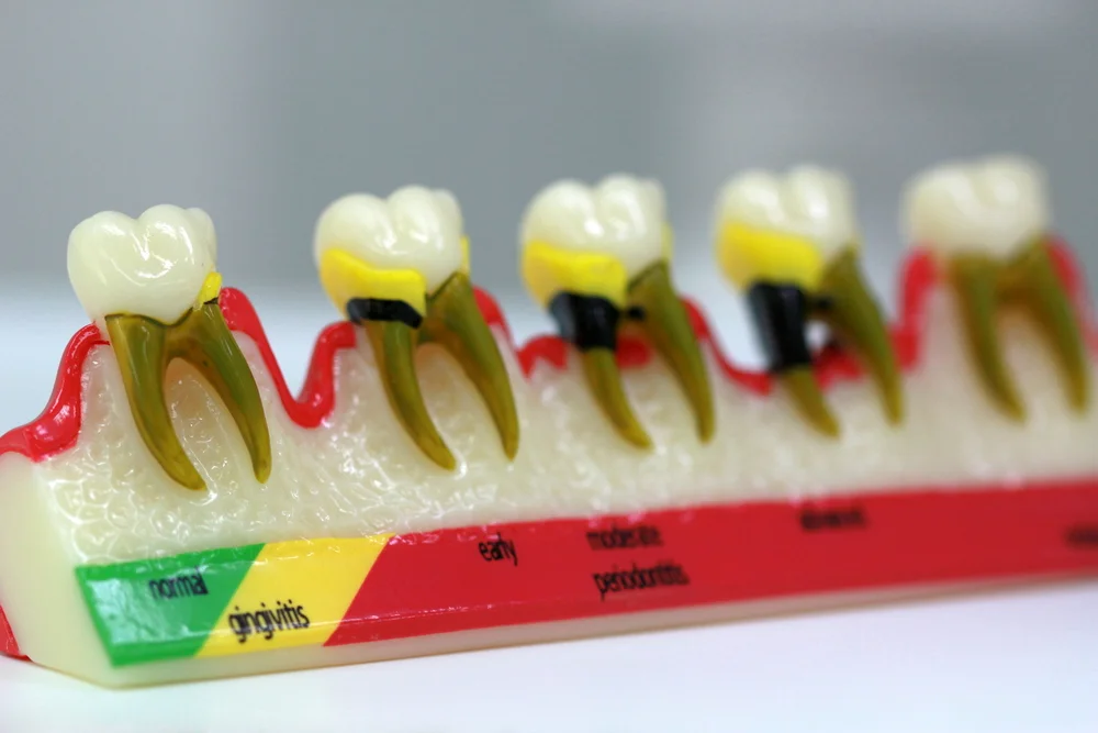 Emergency Dental Care Yishun Dental Clinic Shuang Dentistry