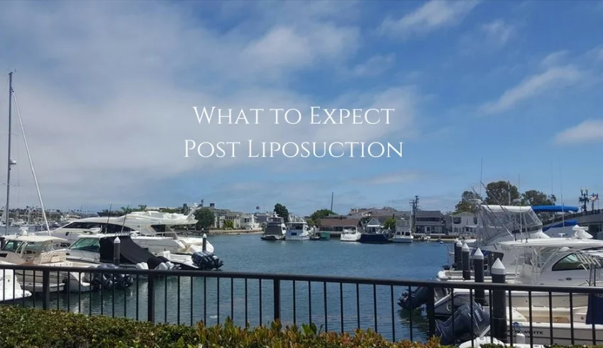 What to Expect Post Liposuction