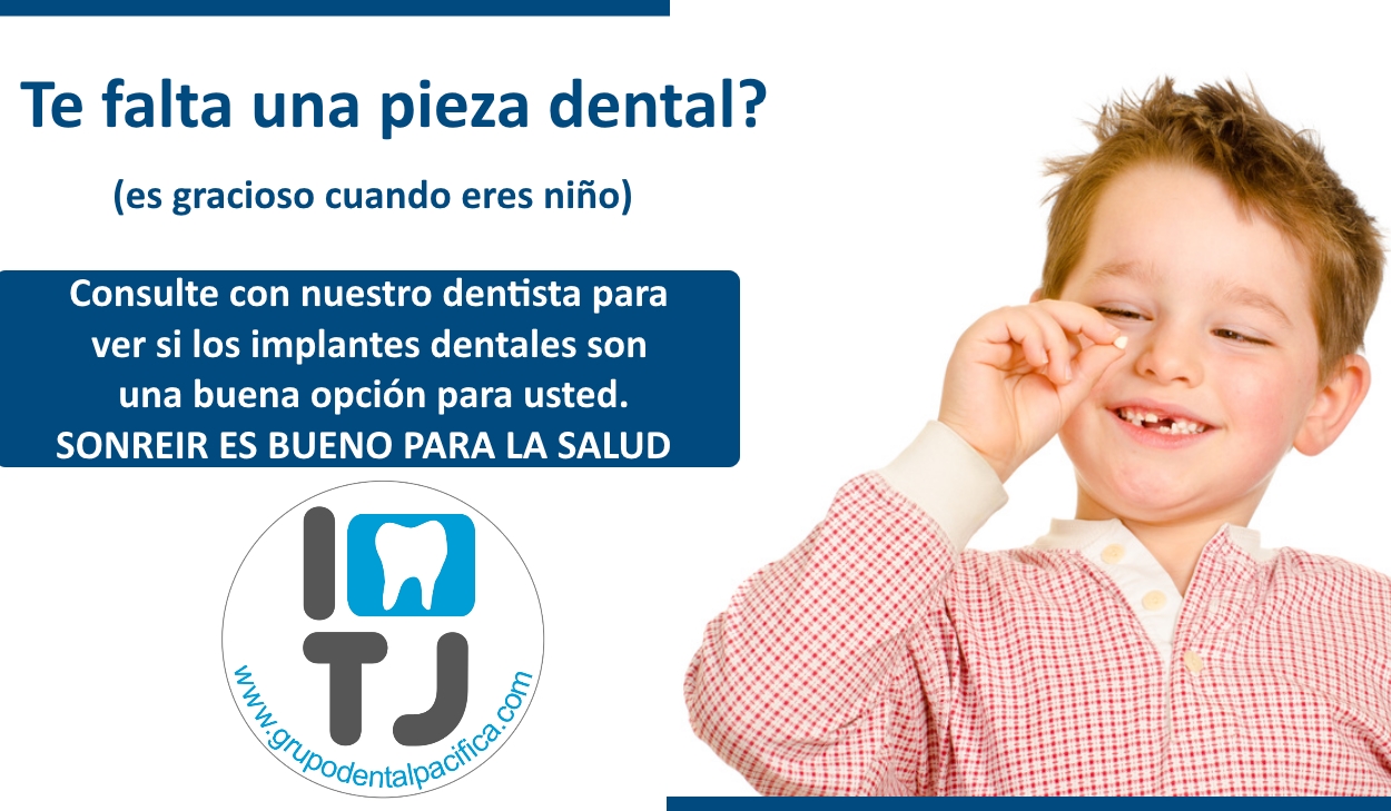 I love TJ Dentista Tijuana Precio de Implantes - grupodentalpacifica.com