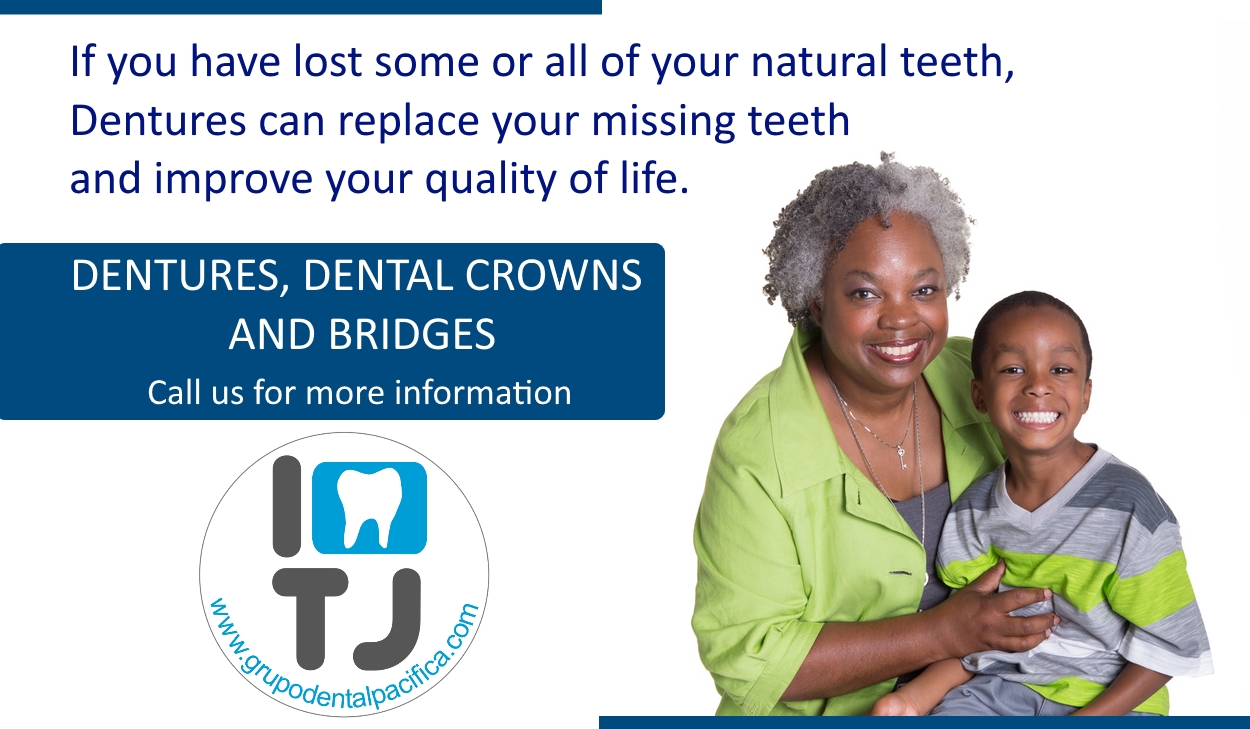 I love TJ Dentures Dental Crowns and Bridges grupodentalpacifica.com