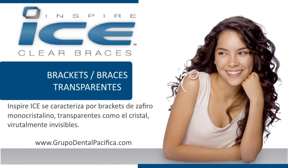 Braces_Brackets_Precios_Tijuana_Clinica_Dental.jpg