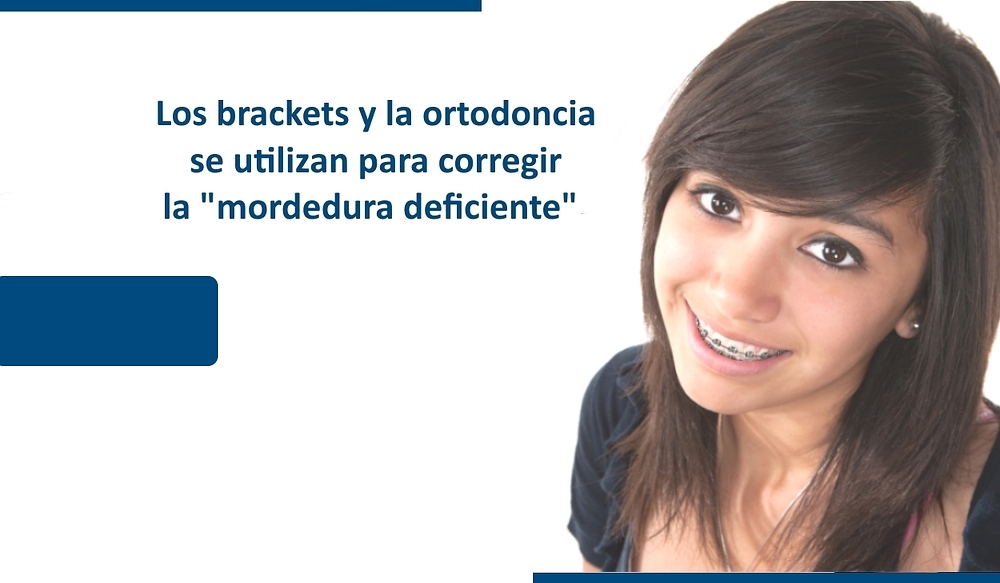 www.GrupoDentalPacifica.com Brackets | Braces | Ortodoncia
