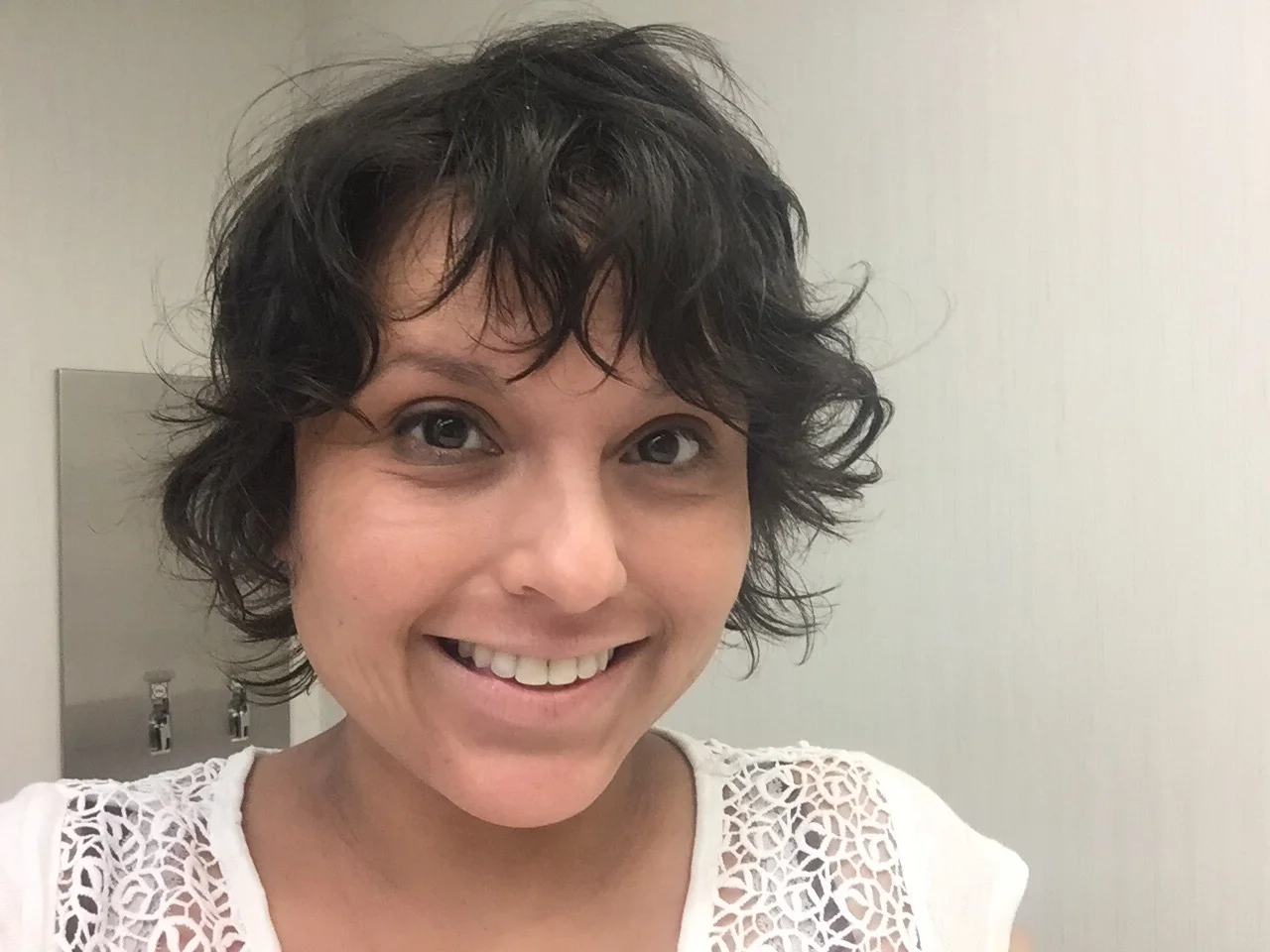 My beautiful face two days ago!