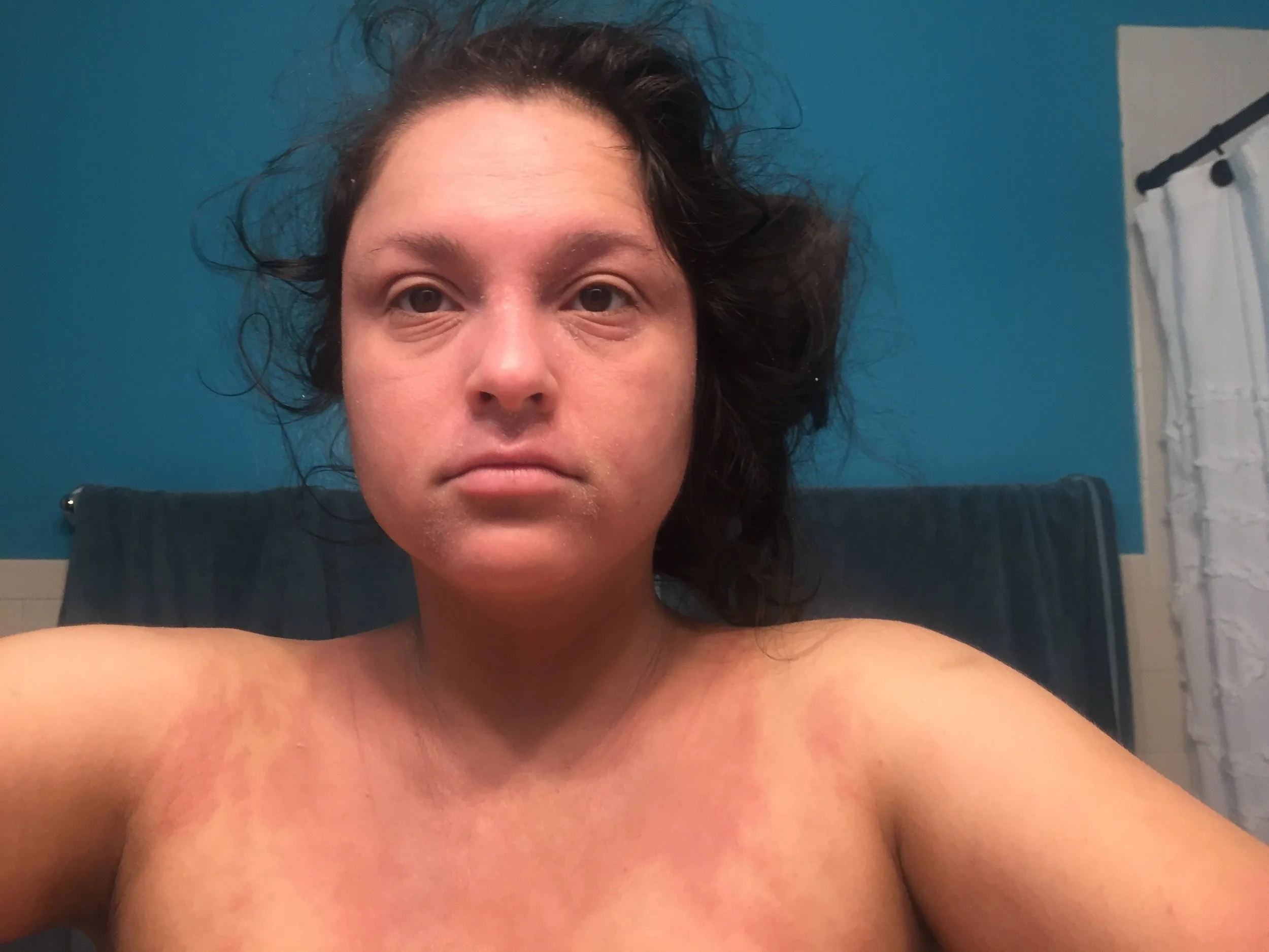 pregnancy_with_eczema.jpg