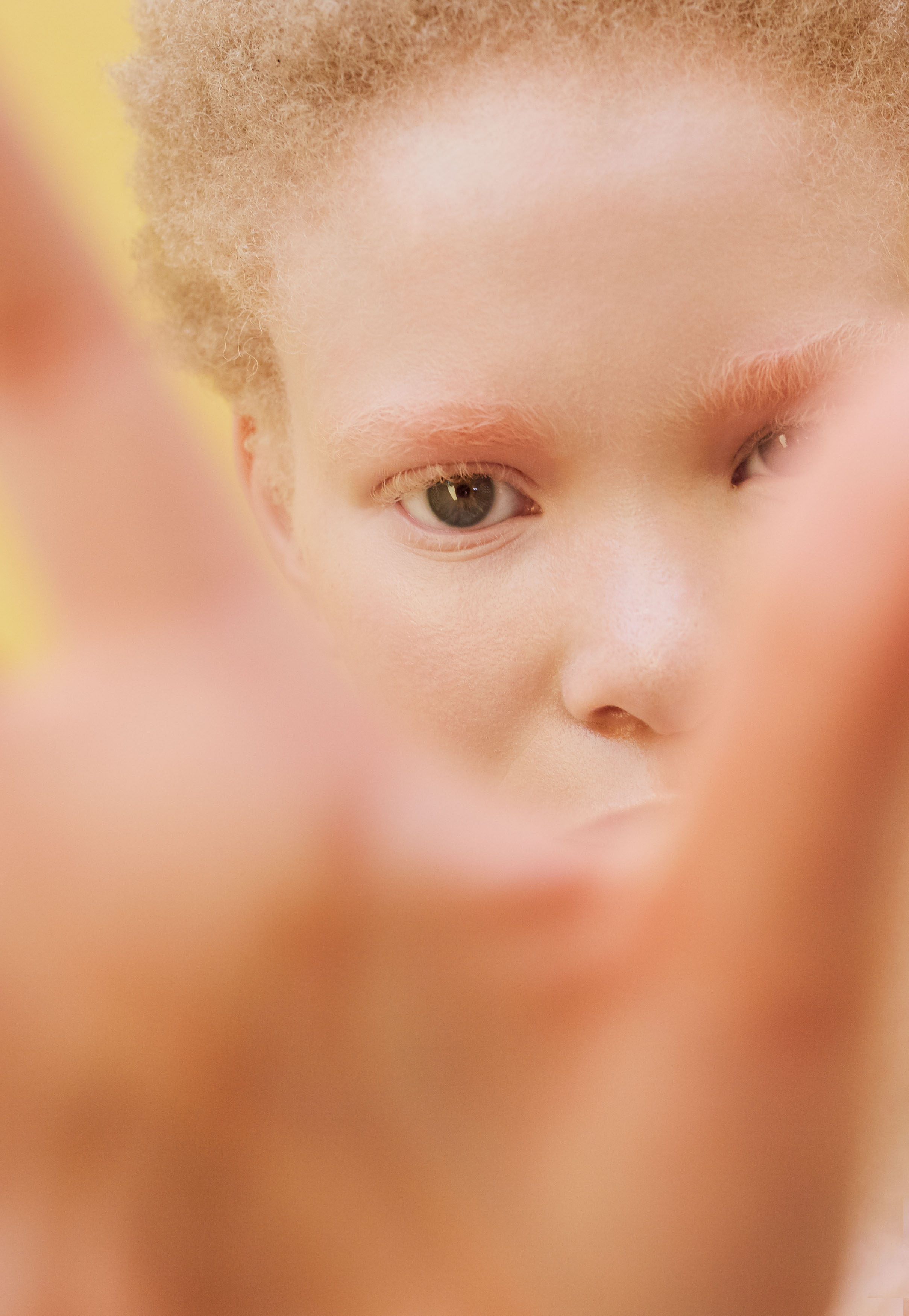 African Albino Beauty Editorial -3.jpg