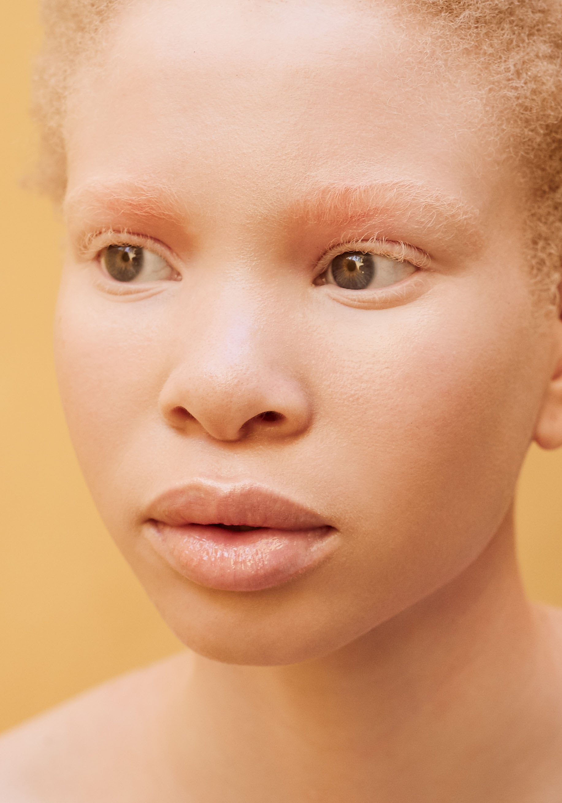 African Albino Beauty Editorial -2.jpg