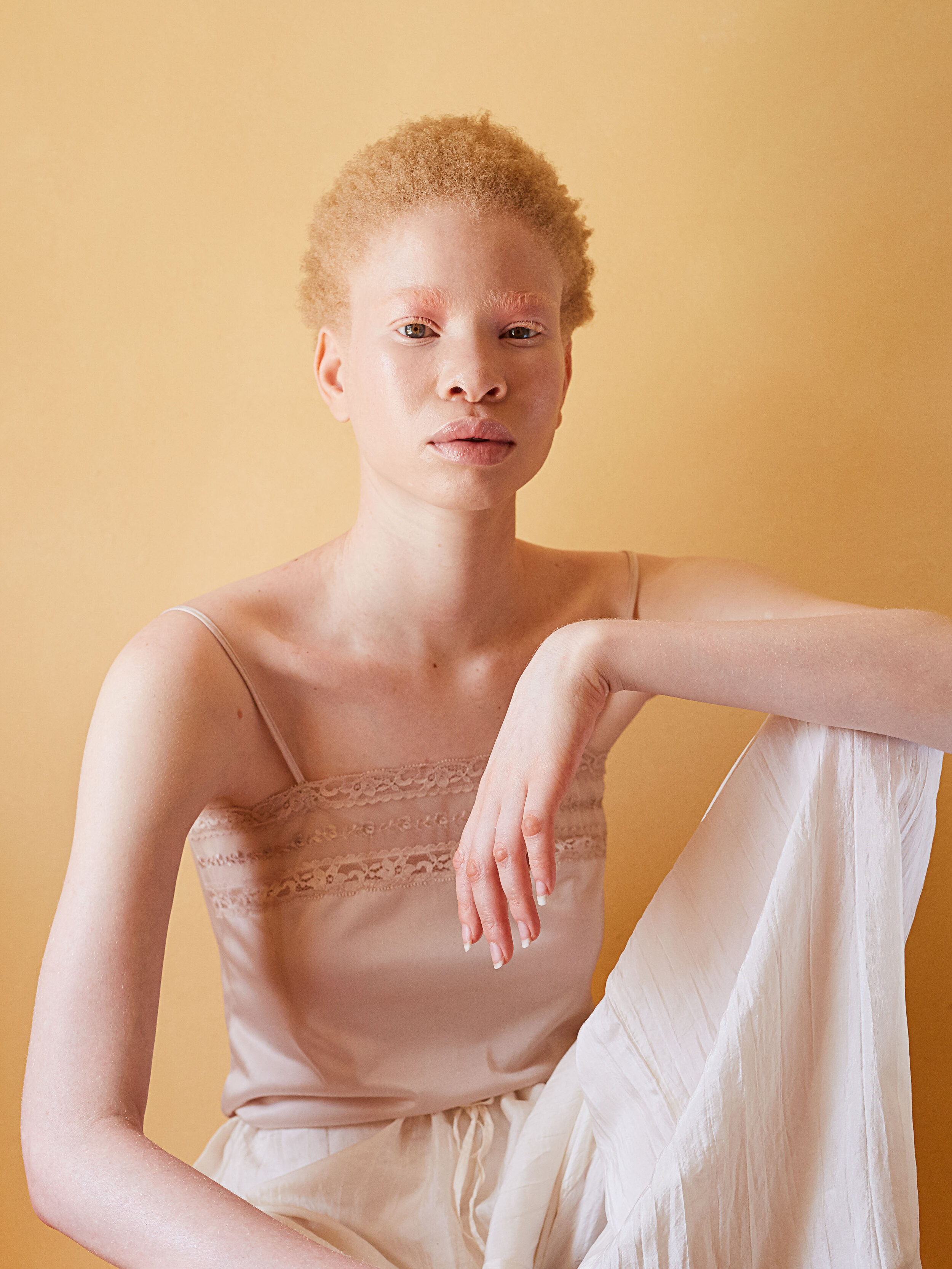 African Albino Beauty Editorial -6.jpg