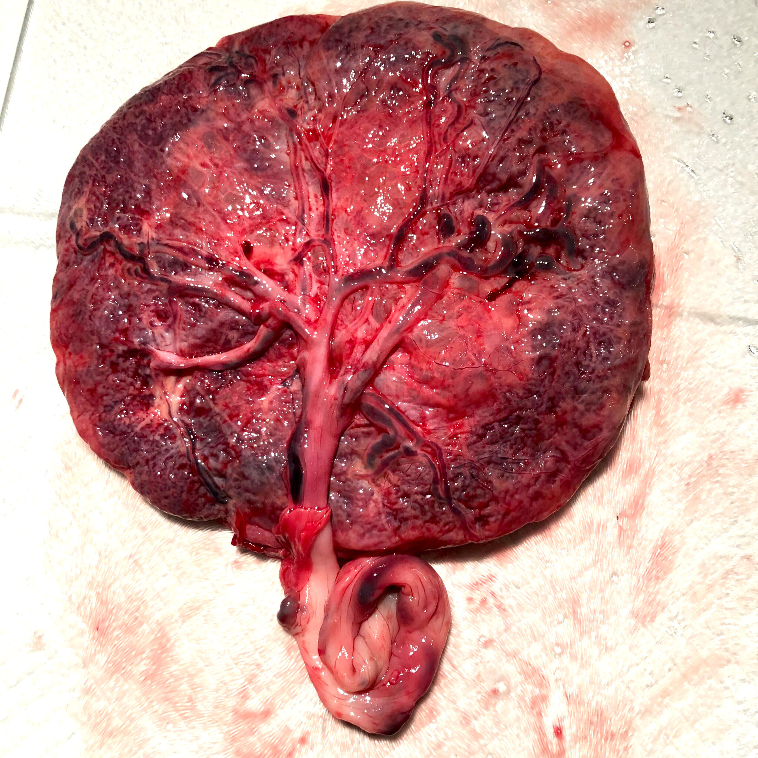 Placenta-1.jpg