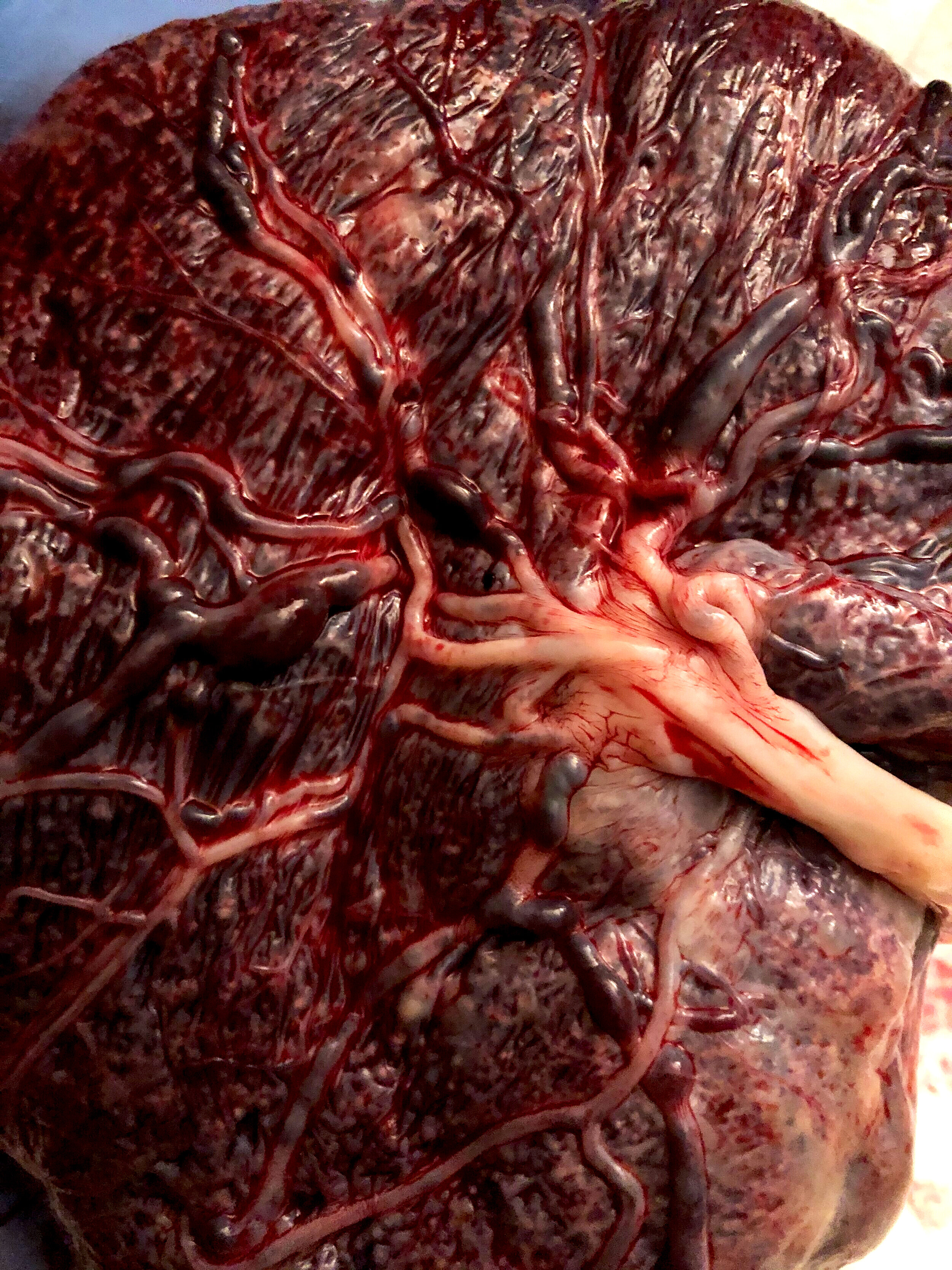 Placenta+Up+Close.jpg