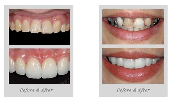 Before and After Examples