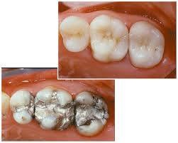 Before and After Examples