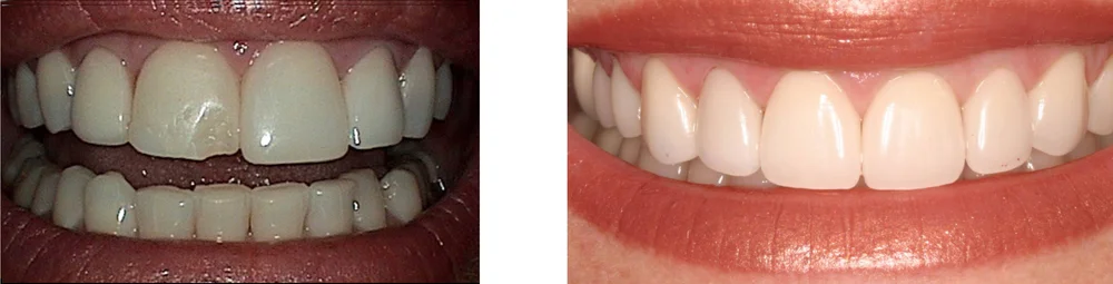 Before & After