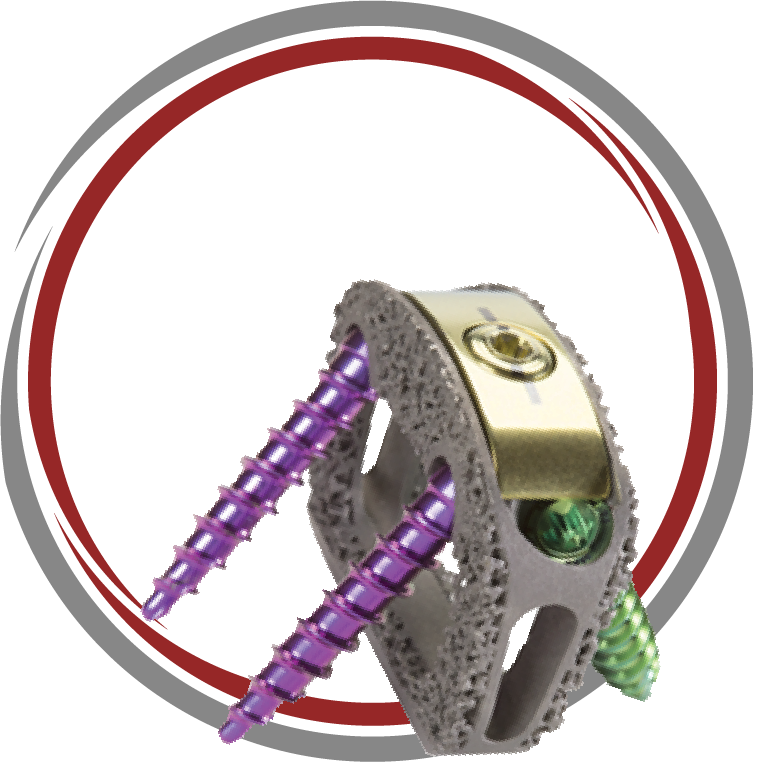 TESERA™ SA