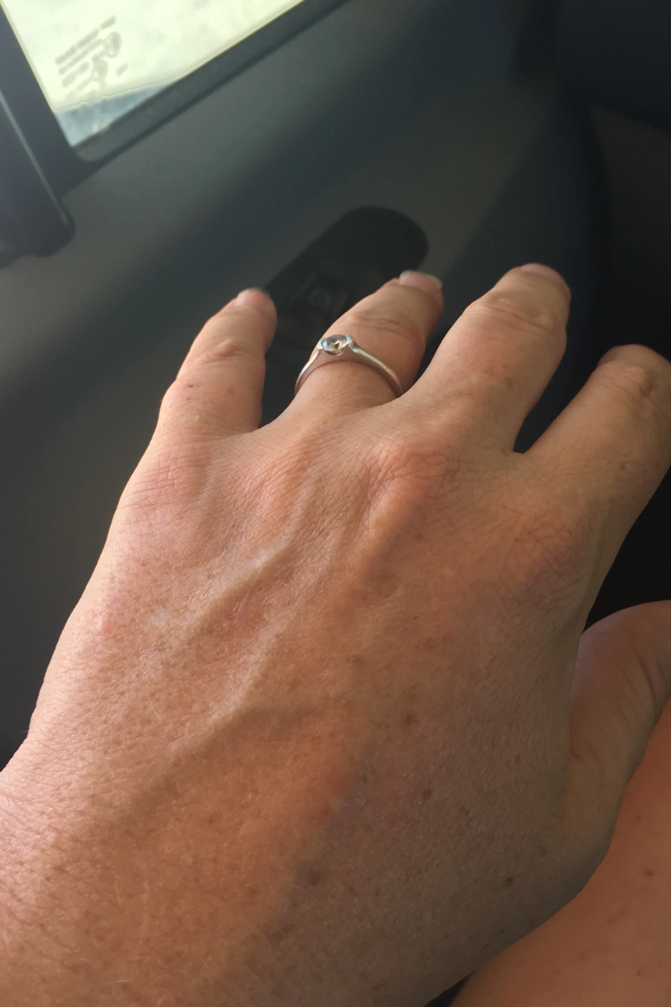 Normal hand