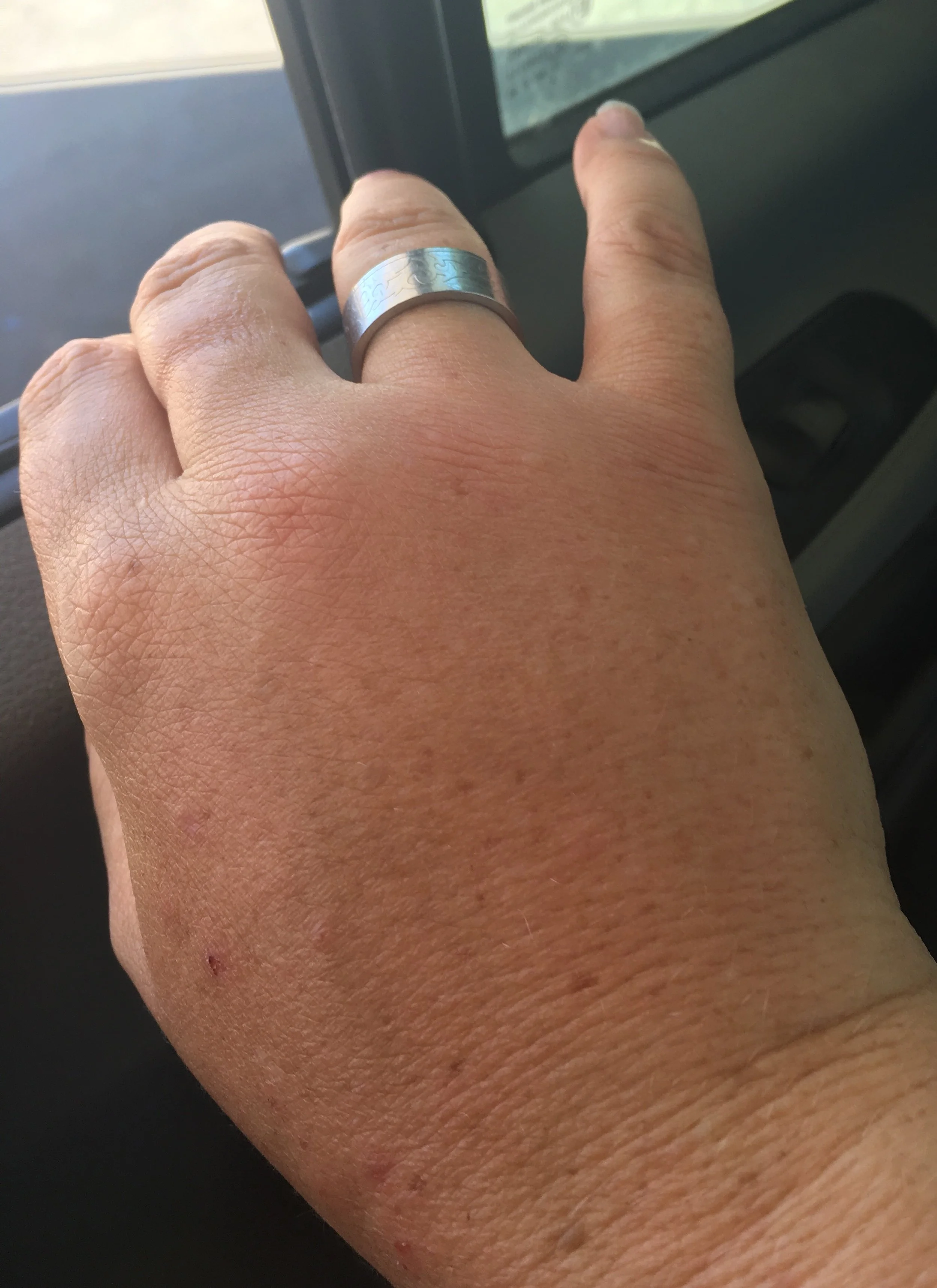 Fat hand!