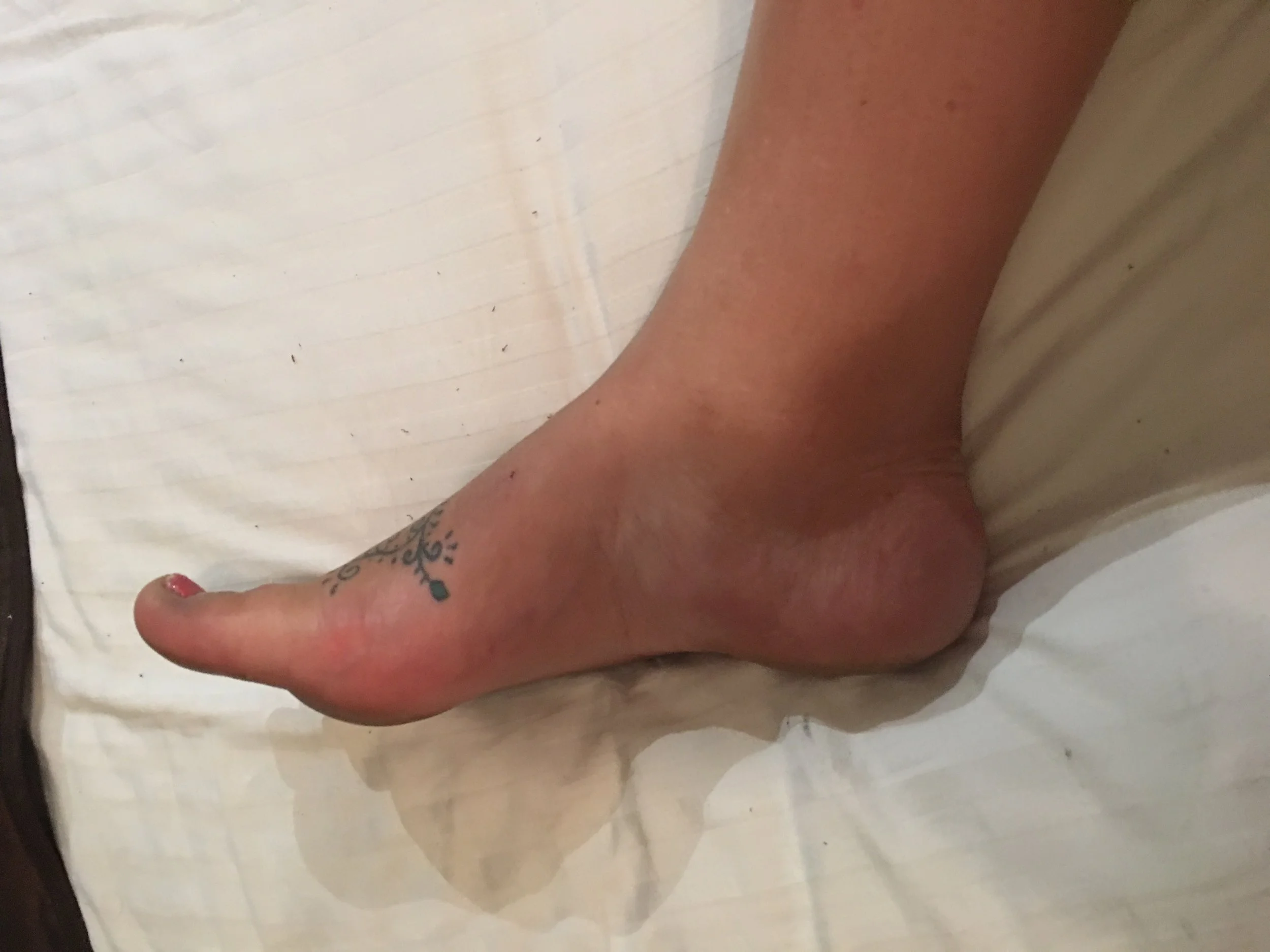 My swollen ankles & feet :( 