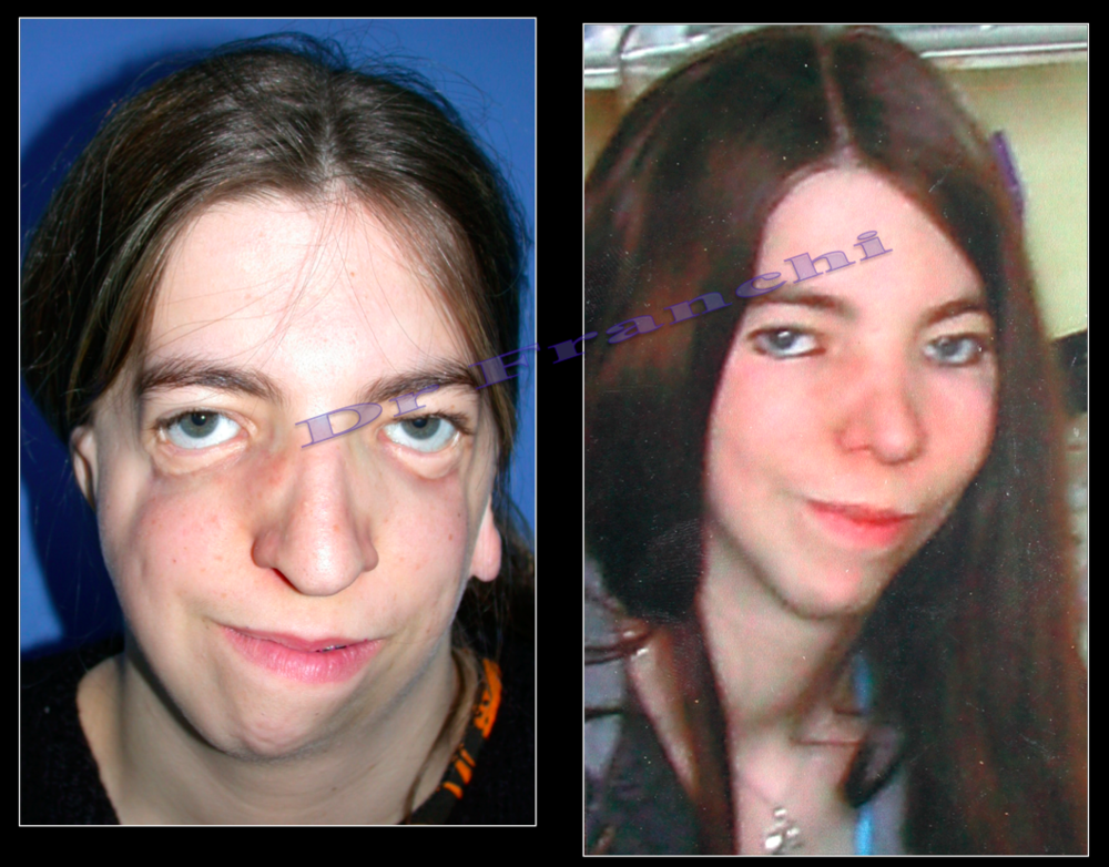 chirurgie-reparatrice-paris