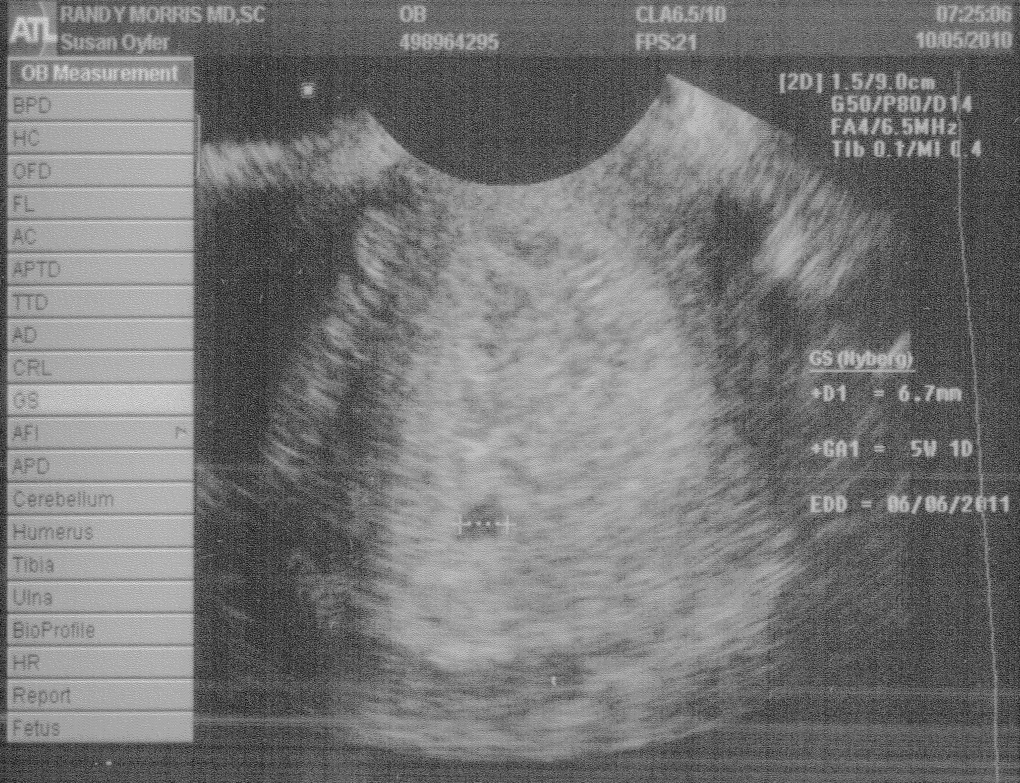 Ultrasound.jpg