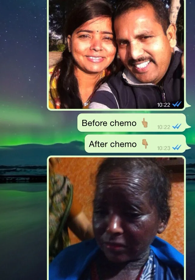 An indian patient who got in touch with the GLM organisation after suffering from severe side-effects of chemotherapy and radiation, one of the two conventional treatments that the current health care chooses to treat CANCER patients. Prohibition of a safe medicine like Cannabis would expose any patient to such harsh treatments. It can also be you or our loved ones in the near future.
