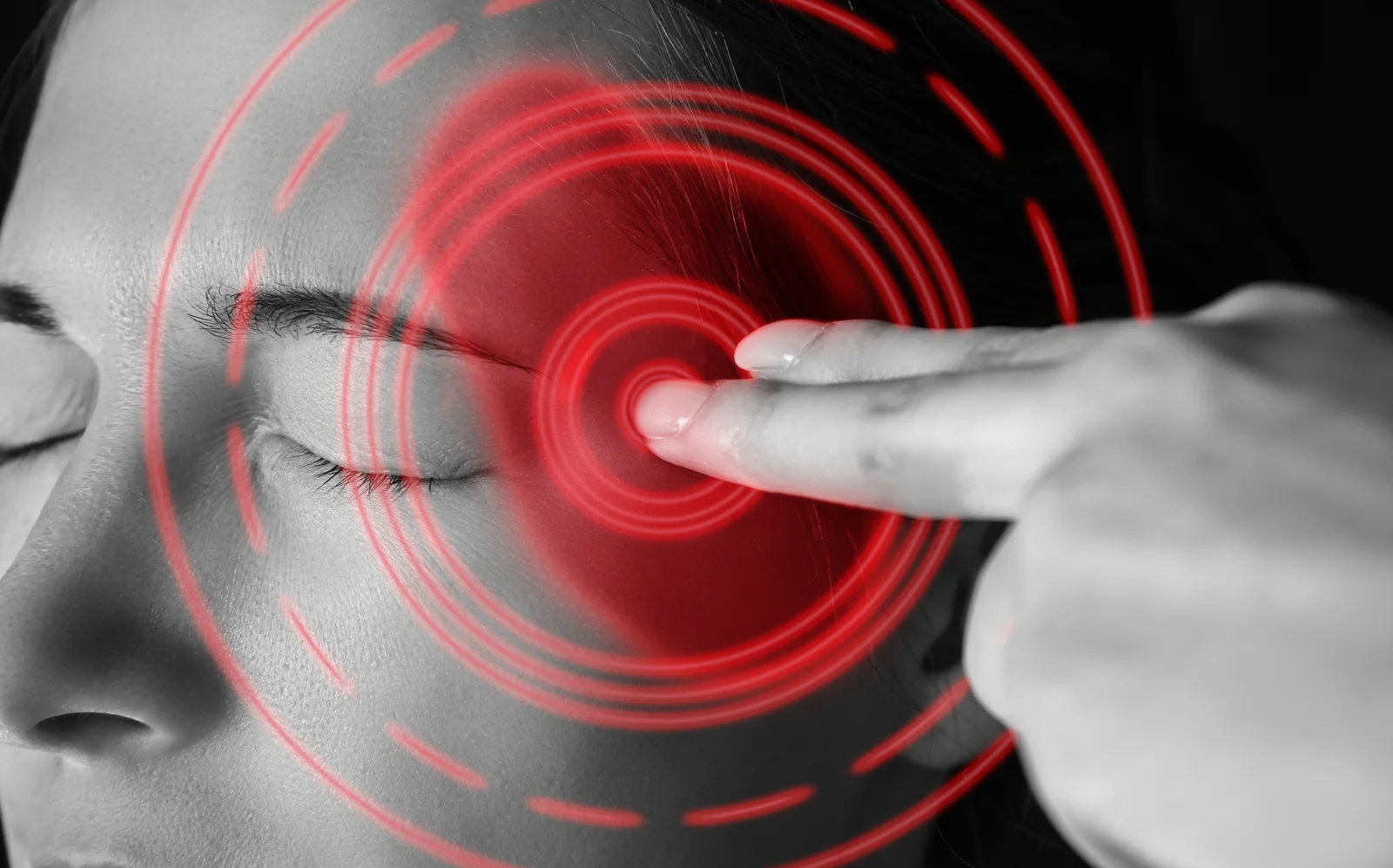 Just How Common Are Migraines?
