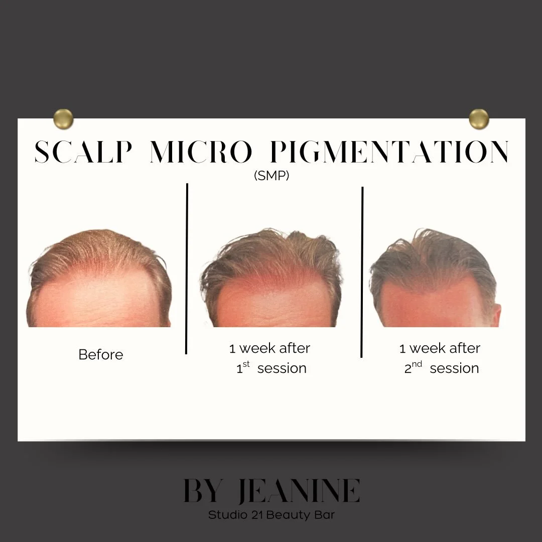Confidence starts at the scalp 💫

Scalp Micropigmentation (SMP) is for both men and women! Whether you&rsquo;re dealing with thinning hair, receding hairlines, or overall hair loss, SMP creates the look of natural hair follicles for a fuller, more d