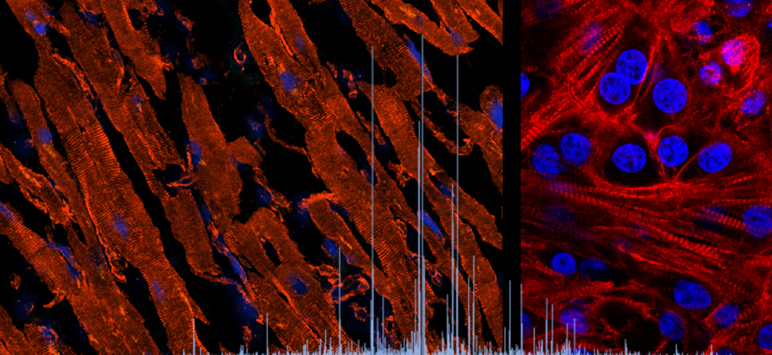 MS_Tissue_CM.png