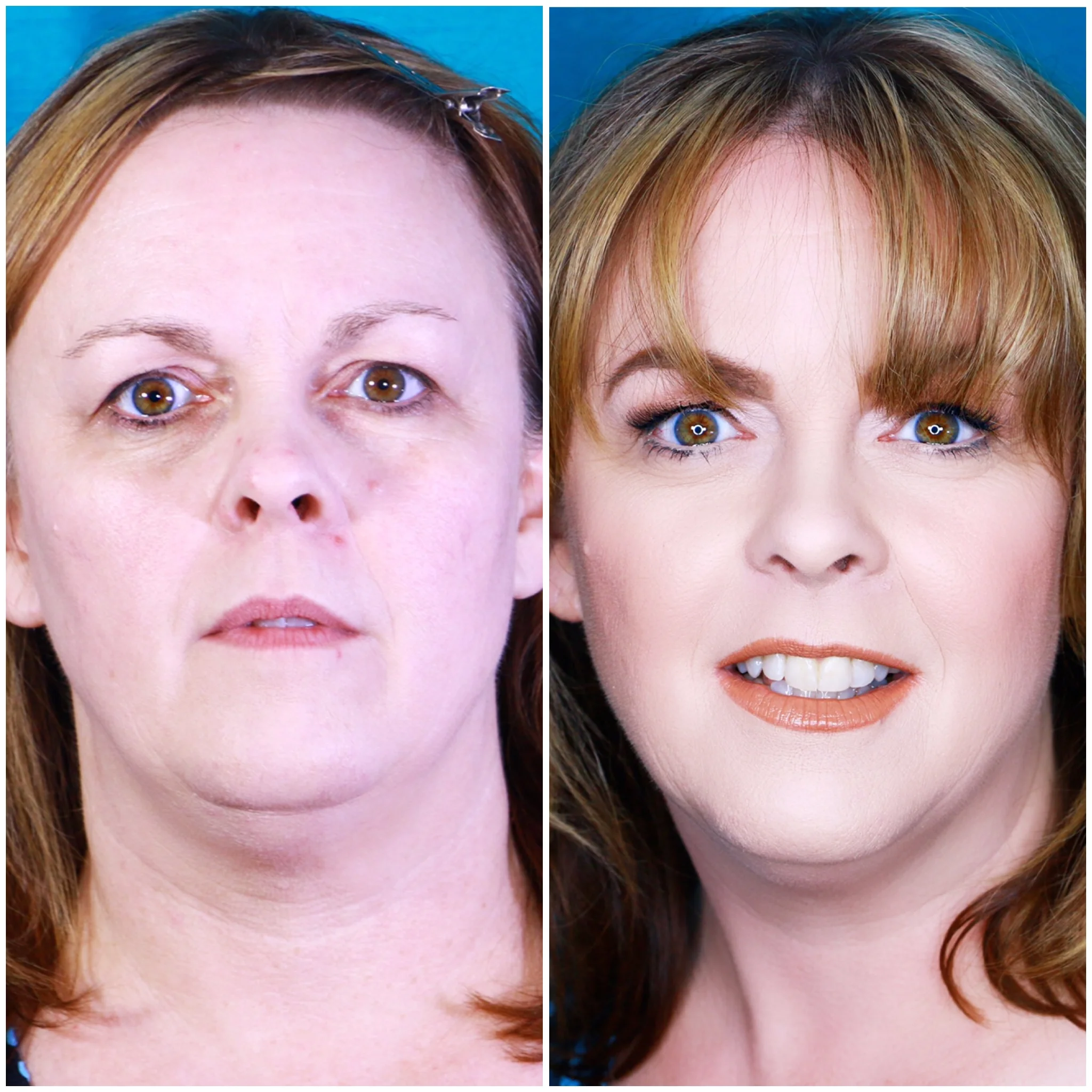 " My husband purchased a private makeover with Mathias for me and what a great gift it was! Had a great time at his makeup studio and learned a lot of great tips. I immediately felt comfortable and like we had been friends for years. My only regret is not having done it 20 years ago! I have gotten compliments now on my eye makeup. With his videos you can go back and watch to get refreshers on what to do. Thank you Mathias! " - JANET