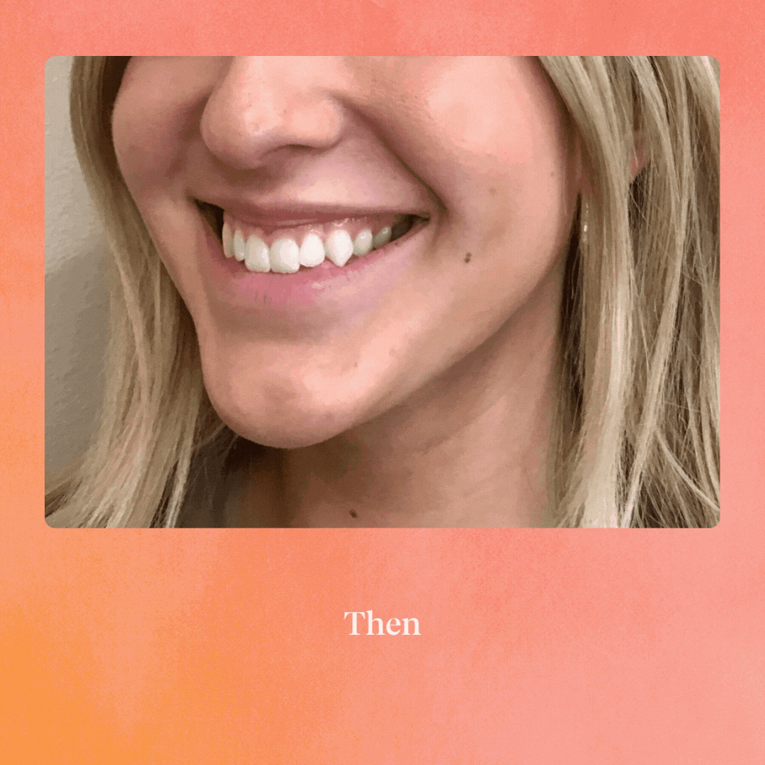 BEFOREAFTER template - Horizontal.gif