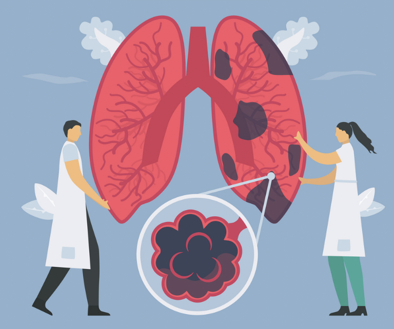 COPD 