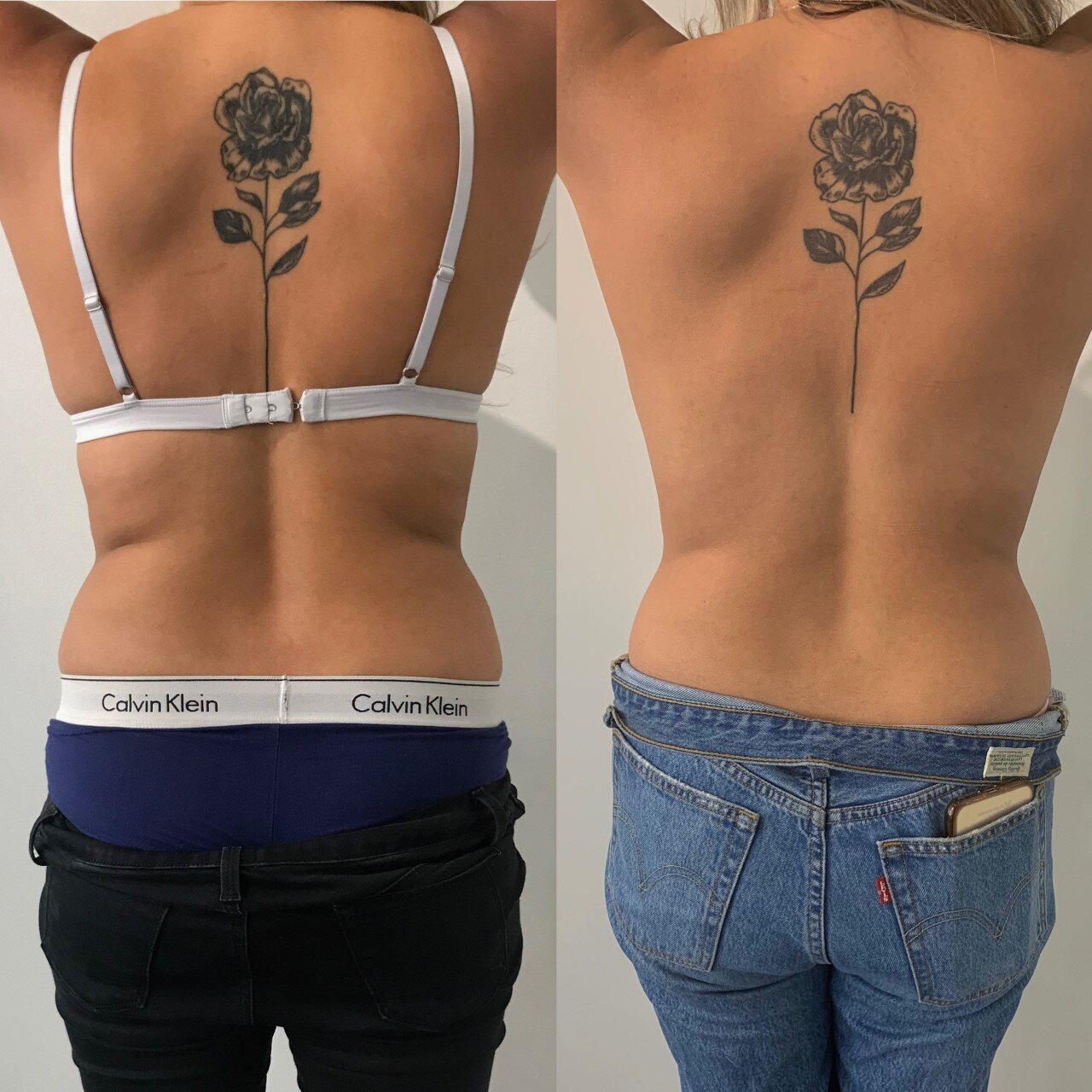 Body Contouring with Body FX and Mini FX - Get Rid of Stubborn Fat  Non-Invasively — Schulz Beauty & Body