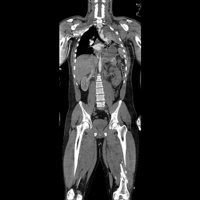 Full Body CT