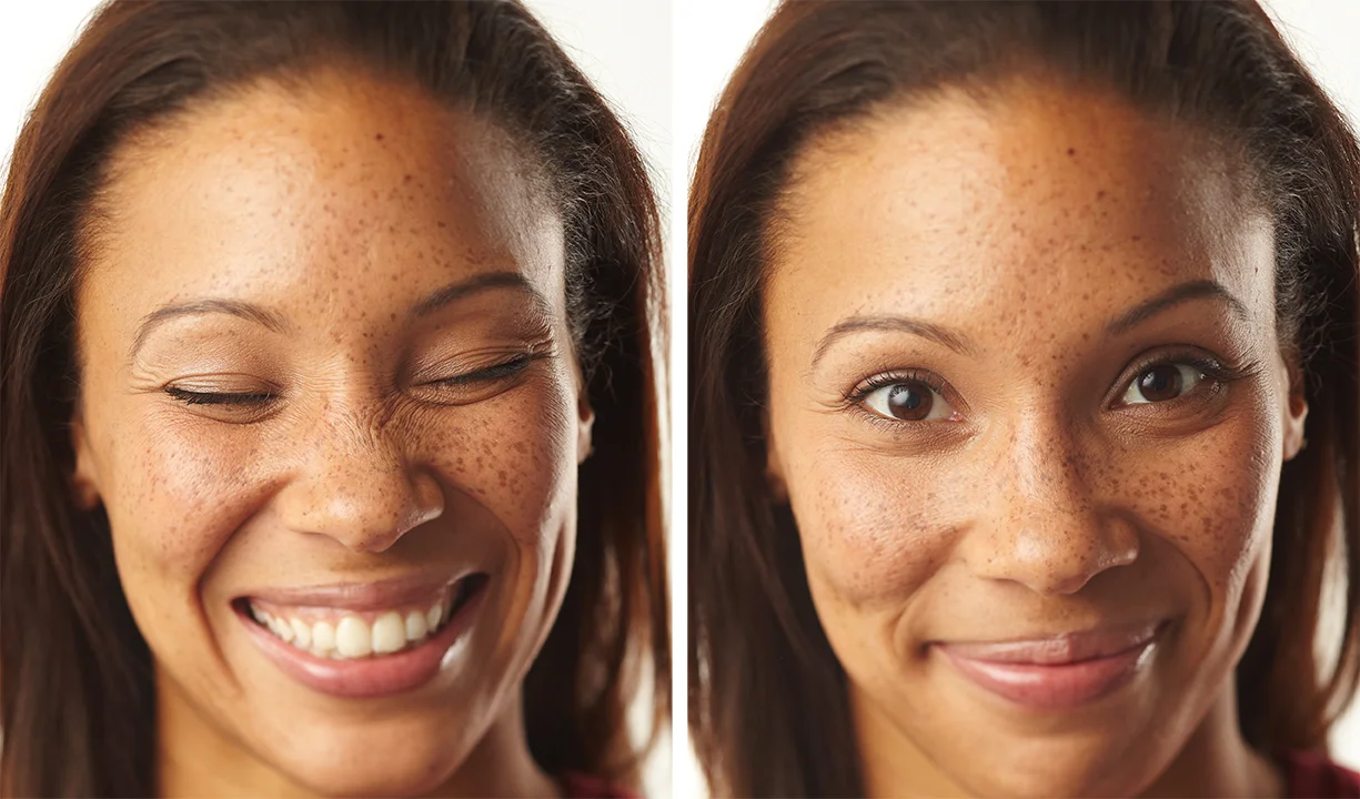 Freckles.jpg