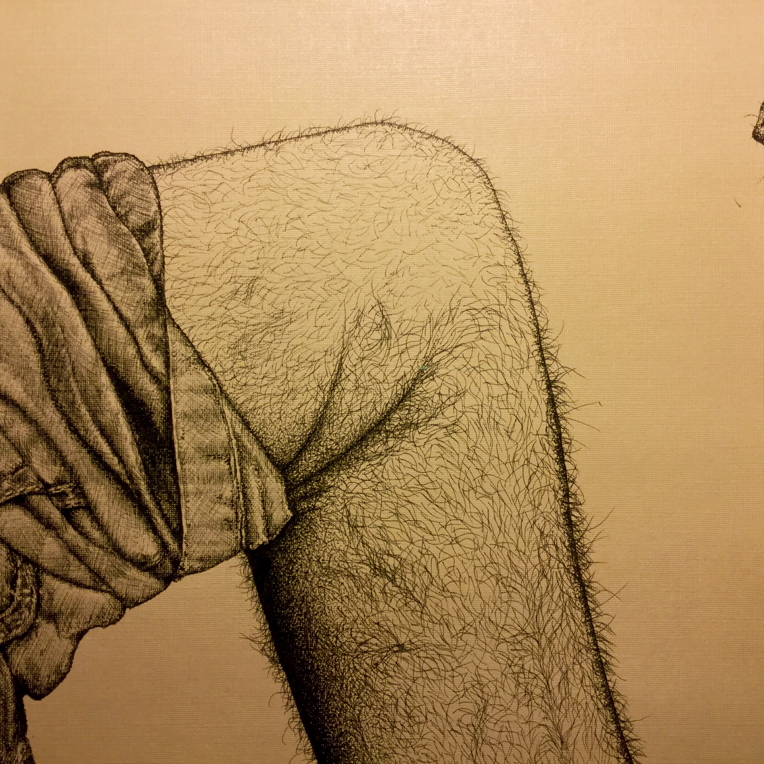 Knee and Unknown Object