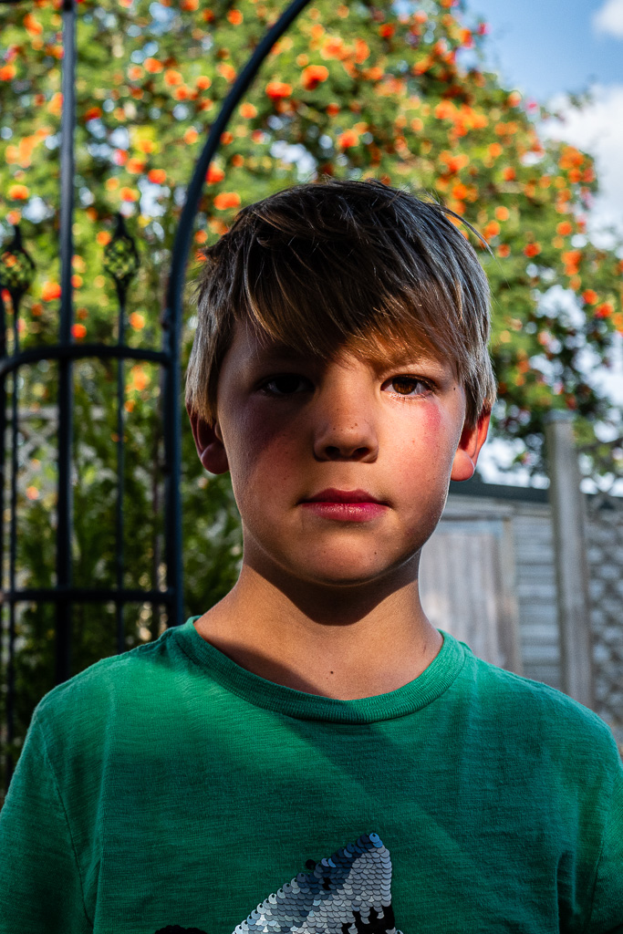 portrait-boy-black-eye.jpg