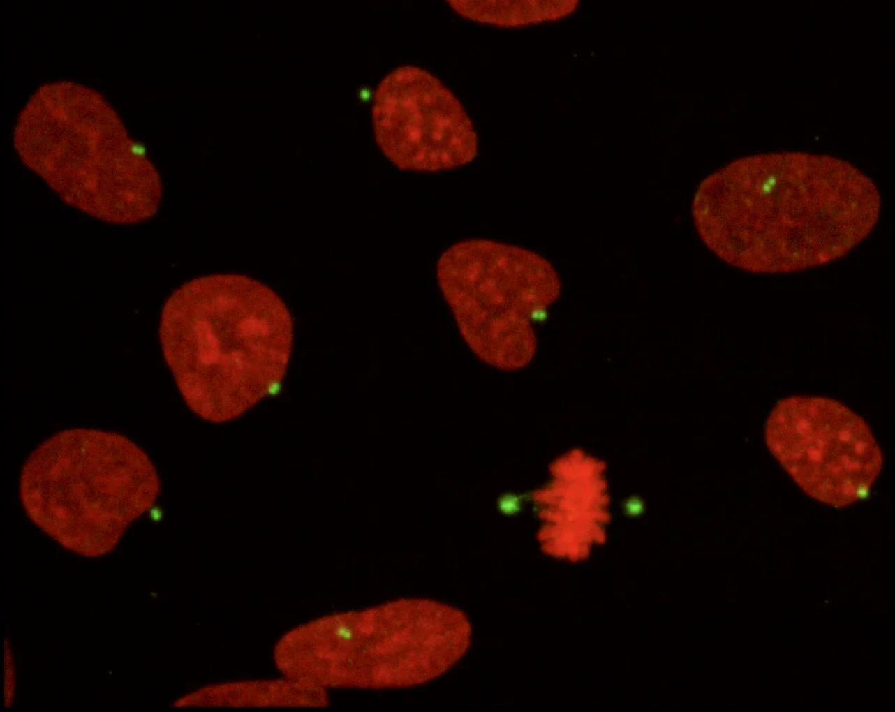 Centrosomes_human.jpg