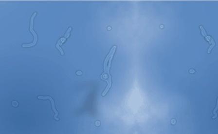 Vitreous floaters against a blue sky