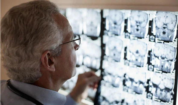 super-agers-brain-scans-788387.jpg