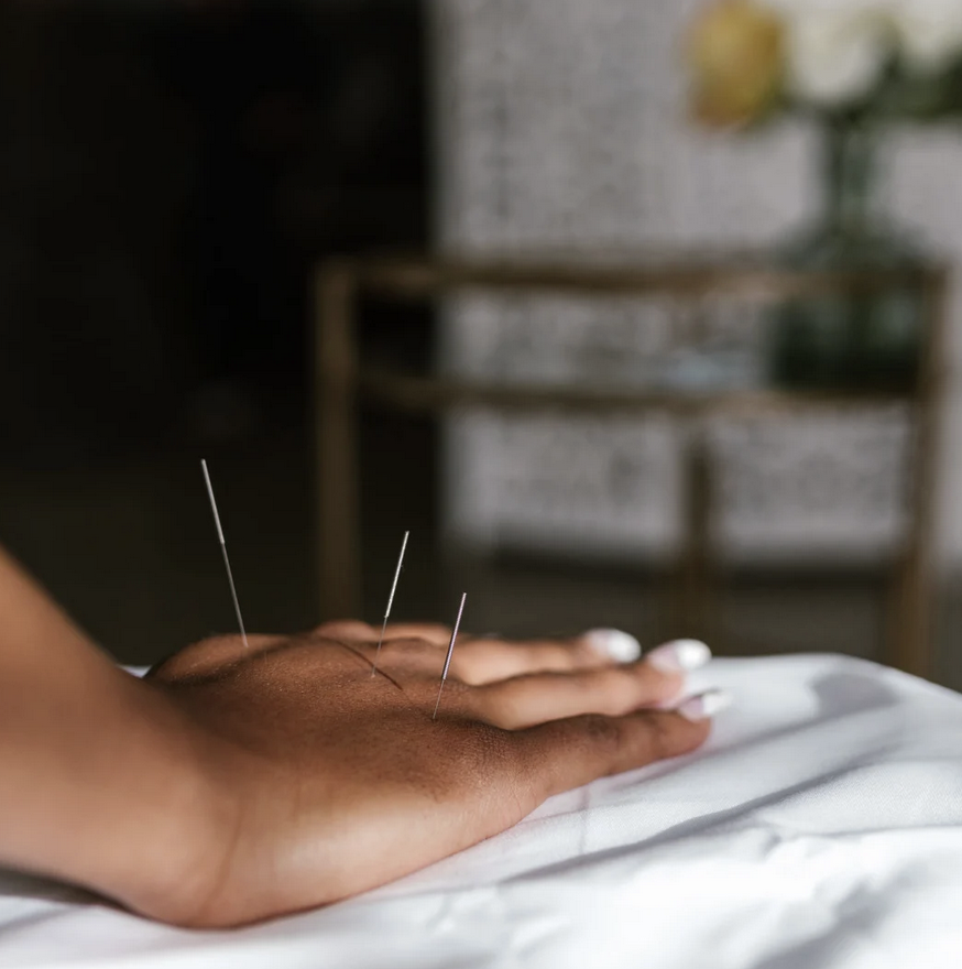 Understanding Acupuncture as an Essential Health Benefit in Oregon: What It Means for You