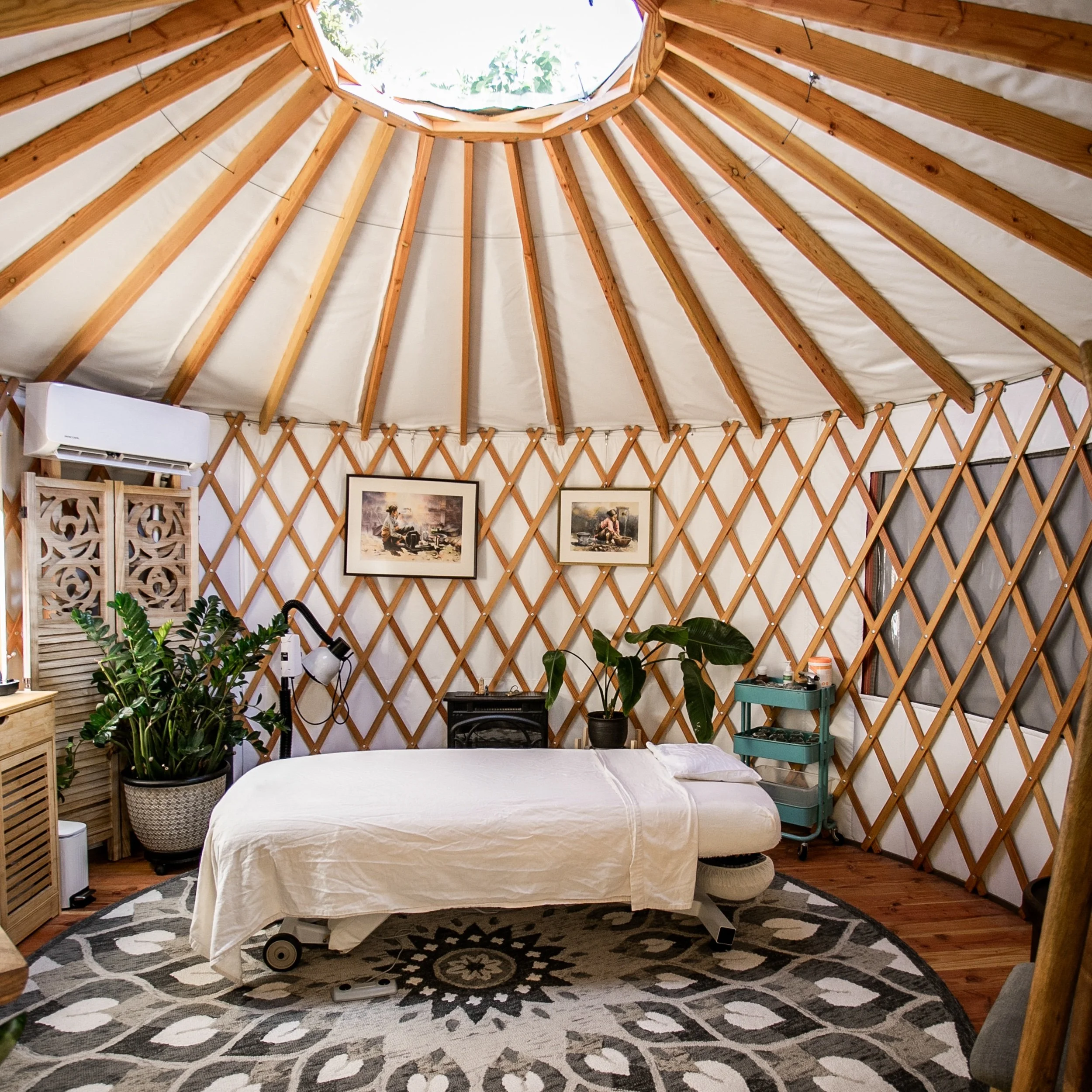 The Unique Benefits of Yurt Acupuncture