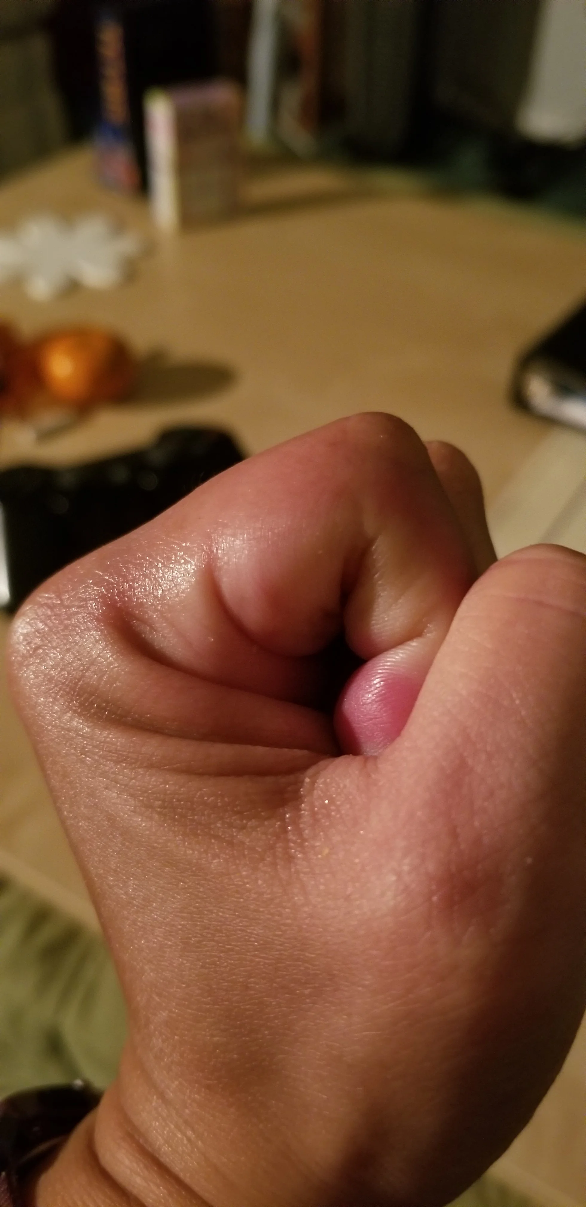 Almost a fist. Steady progress.