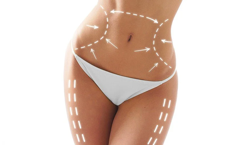 liposcultura Renata Fanca Floating Flo.jpeg