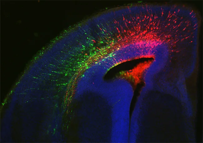 Biohacking setkání