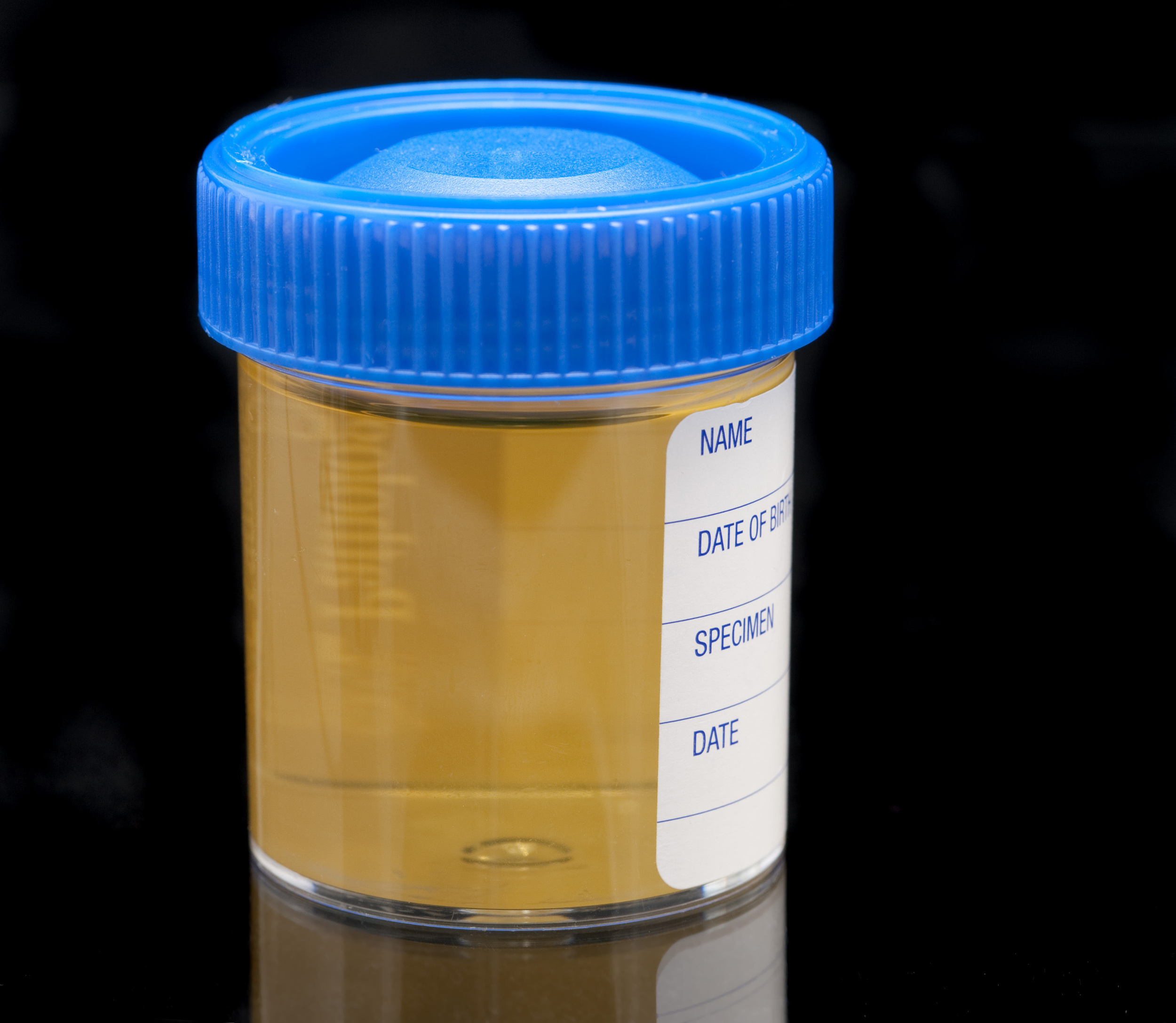 Refusing a Breath Test and Offering to Take a Urine Test is Still an OVI Refusal - DUI News - 7/22/2016
