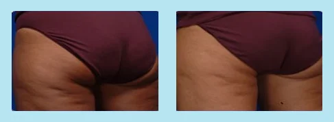 Accent your body