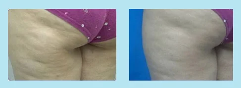 accent your body 2